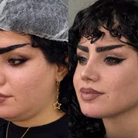 جشنواره کلینیک زیبایی روکال
