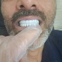 دندان سازی رامیار منبری درسنندج یکر‌وزه