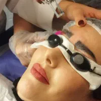 پاک کردن تتو ابرو بدن چشم بالیزرکیوسوئیچ