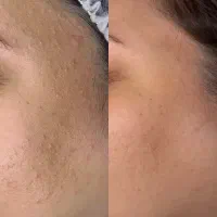 فیشیال تخصصی و مراقبت پوست