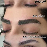 ۵۰٪ تخفیف پاک کردن تتو ، فیبروز ،میکرو، شیدینگ