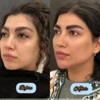کلینیک تخصصی ژل و بوتاکس