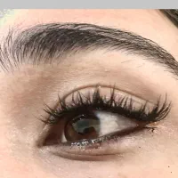 کاشت هیدن انواع مدل ها تخفیف یک هفته ایی