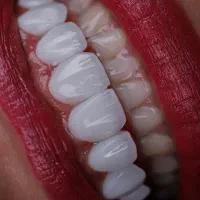 لابراتوار فوق تخصصی دندانسازی نیودنت ثابت و متحرک