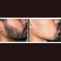 حجم ریش و سبیلتون دو برابر کن