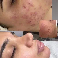 فشیال پاکسازی تابستانه از 350
