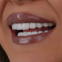دستیار دندانپزشک