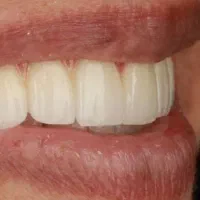 نیروی خانم جهت کار در لابراتوار دندانسازی