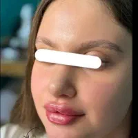 جوانسازی بدون