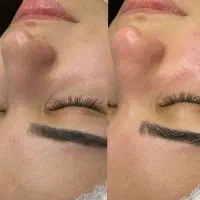 پکیج های تخصصی پوست‌ زیبایی و درمانی