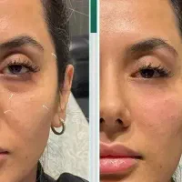 جوانسازی پوست و تزریقات پزشکی زیبایی و لیزر