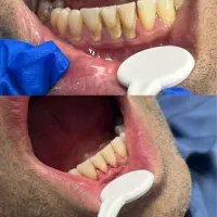 جرمگیری دربروجرد