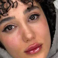 ژل لب تکنیک mکلینیک زیبایی امیر