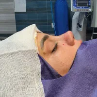 عمل بینی توسط جراح پلاستیک ۴۰ میلیون