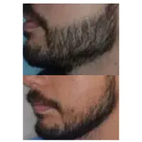 چهره ی جذاب و ریش کاملتو به من بسپار