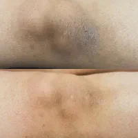 صابون سفید کنندگی رفع تیرگی و لک بدن صورت و دست