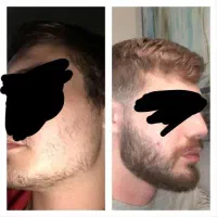 ریشای کم پشت بسته چهره جدید بساز