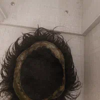 کلاه گیس خارجی