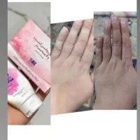 روشن کننده پوست