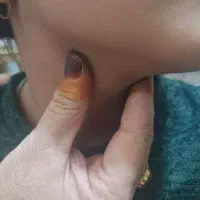 طول گیری.بندی.کام و لوزه بالازدن رگ هول