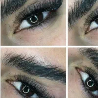 کاشت مژه هیدن