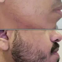 با من ریش دار شوو