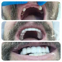 ارائه خدمات دندانپزشکی(کاریزما)