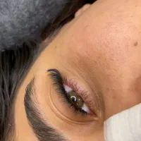 کاشت مژه هیدن( ریسه ای )