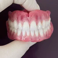 خدمات تخصصی دندانسازی دندان مصنوعی ژله‌آی و روکش