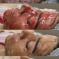 فیشیال تخصصی وپاکسازی پوست
