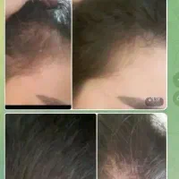 طب سنتی ومزاج شناسی