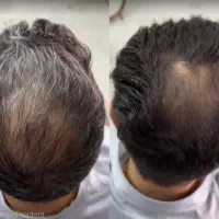 چرا محصولات قبلی برای موهایت نتیجه ندادند