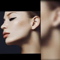 تخفیف ویژه ساکشن و جراحی های زیبایی