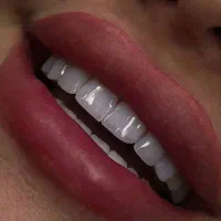 دندانپزشکی دکترعزیزی طرف قرارداد با بیمه تکمیلی