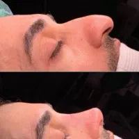 جراحی/زیبایی/بینی با مجرب ترین تیم جراحی بینی