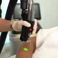 جشنواره تخفیفی لیزر دکا