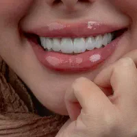 دندانپزشکی،ایمپلنت بدون پیش پرداخت،اقساط طولانی
