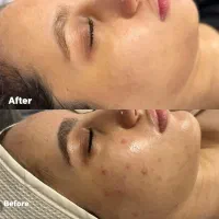 فیشال فشیال وپاکسازی تخصصی پوست