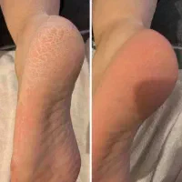 پدیکوروکفسابی حرفه ای۶۰۰ تا ۷۵۰