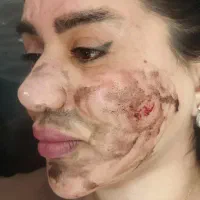 اولین درمانگر لک با متدپکینگ آپ وحذف تک جلسه کک مک
