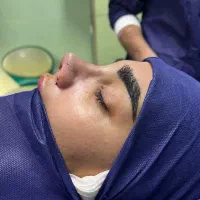 جراحی زیبایی بینی فقط با۲۹میلیون