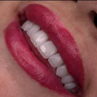 استخدام مشاور فروش کلینیک دندانپزشکی سرو