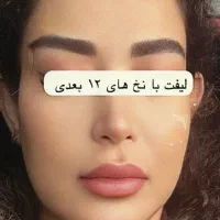 تزریق ژل بوتاکس مزوتراپی جوانسازی مشاوره رایگان