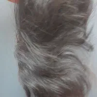 پروتز مو