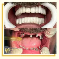دندانپزشکی اقساطی|خدمات آرایشگری و زیبایی|تهران, کامرانیه|دیوار