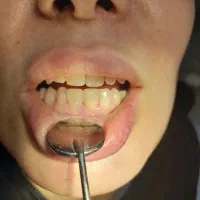 دستیار دندانپزشکی