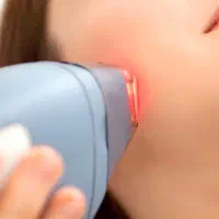 همکاری با دارنده دستگاه لیزر،ماما،کاشت مو