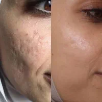 دمودکس|آرایشی، بهداشتی، درمانی|چابهار, |دیوار
