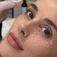 مزوژل جوانساز/راز پوستی شفاف، باطراوت و جوان‌تر