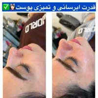 مدل خدمات پوست و زیبایی